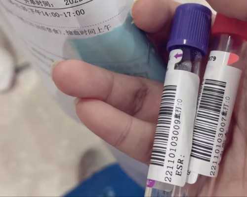 四川供卵公司电话,四川民间供卵试管机构正规吗？2026正规供卵试管机构名单大