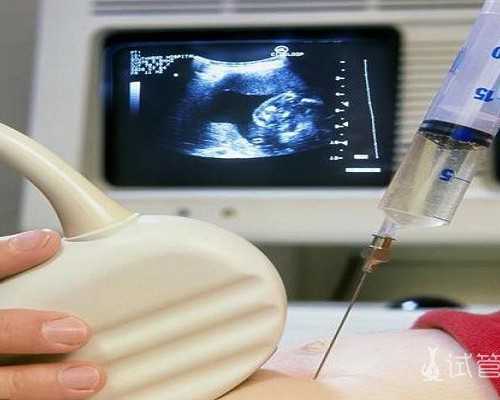 四川全国可以做供卵试管的医院,四川成都不找中介去哪做卵泡小试管婴儿成都