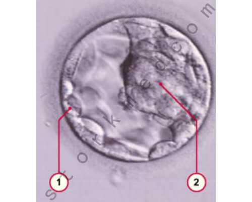 借卵生子如何上户口_国内借卵子生子,阳泉三代试管助孕借卵生子费用大约需要