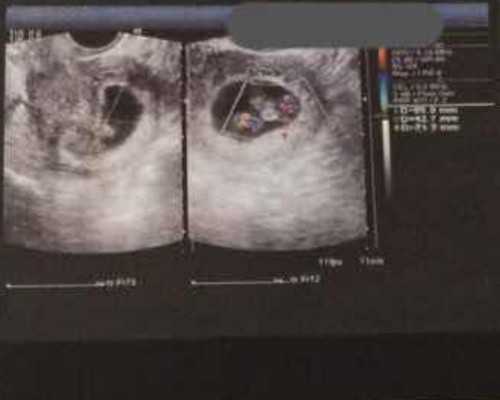 四川代生代怀宝宝,四川广安试管婴儿成功几率有多大