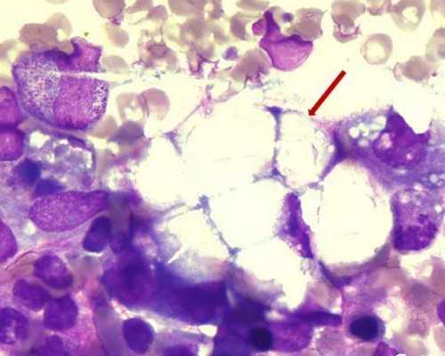 高龄试管多是借卵_借卵试管利弊,45岁高龄女性借卵试管成功率要比你想象的高