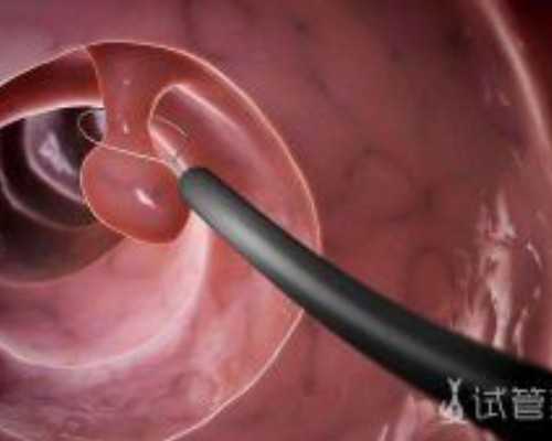 济南试管代怀公司|资阳弱精症患者能做试管吗，男方严重弱精症做试管成功几
