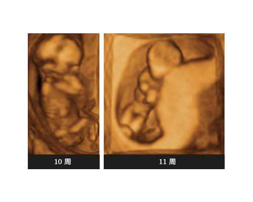 哪里可以借卵_借卵生子流程,九江试管借卵做三代选性别包成功是真的吗？