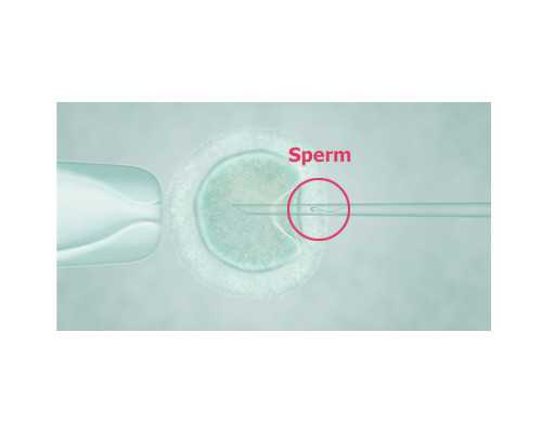 成都助孕微信群,成都试管助孕-四川助孕试管包男孩