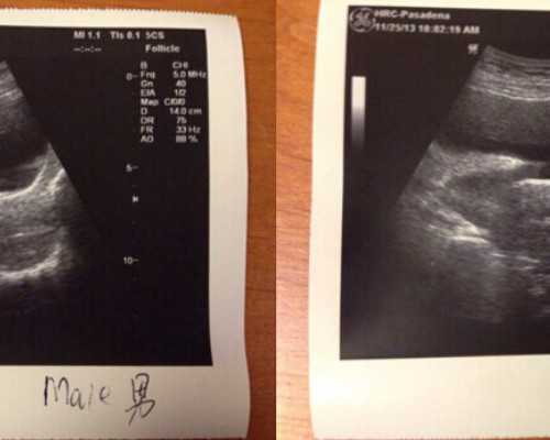 四川宝岛妇产医院的试管婴儿技术,四川宝岛妇产医院介绍