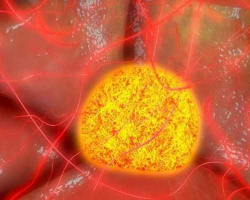 宝宝发烧吃什么菜