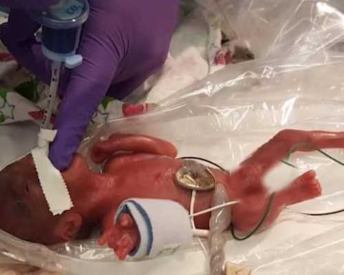 四川三代试管可选性别,四川广汉试管婴儿龙凤胎几率有多大