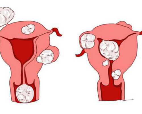 高龄借卵生子成功率_借卵生子成功率,上饶三代试管借卵生子医院排名第一是哪