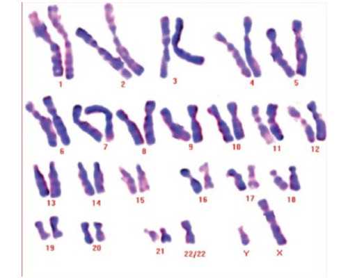 广州代生代怀,北京供卵试管中心移植后HCG翻倍情况不好该怎么办呢-南京供卵试