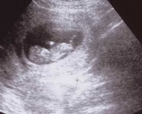 兰州代生,大龄去美国试管婴儿，一般需要几个周期？-上海供卵试管中心地址