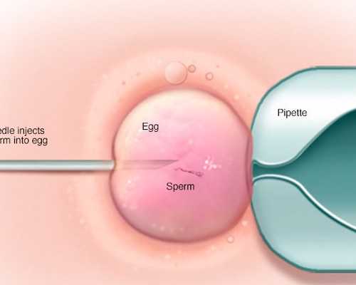 成都同性供卵试管,朝阳马来西亚试管婴儿费用(成都马来西亚试管婴儿费用)