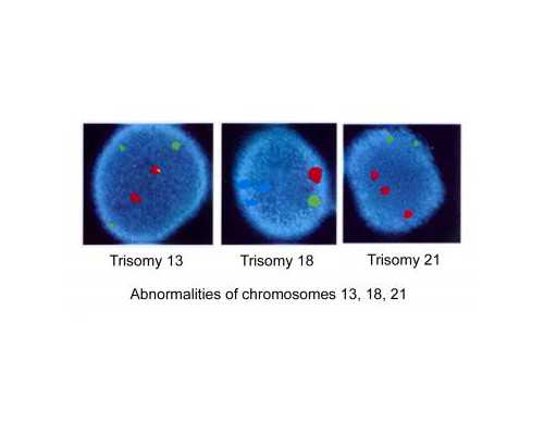 卵巢早衰在四川哪个中医,在四川冷冻卵子费用需要多少?