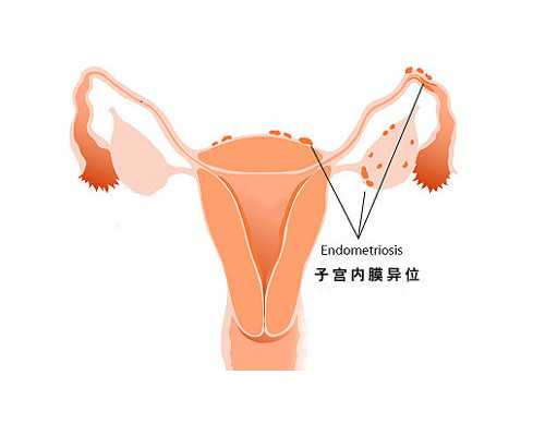 成都包性别代怀地址,成都华西附二院试管婴儿收费是怎么算的