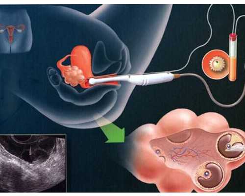 婆媳关系和母女一样吗小说