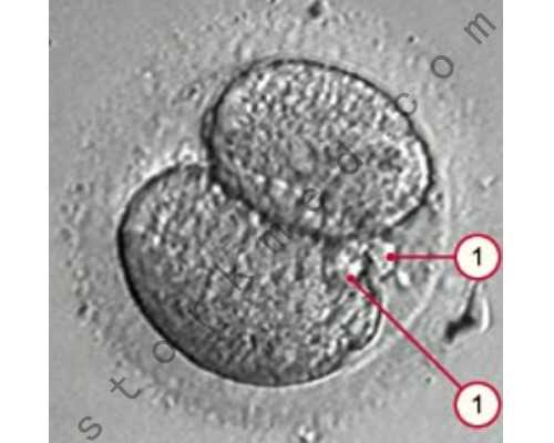 四川三代试管费用公立,2026
年四川生二胎在公立医院能报销多少钱，四川生二胎